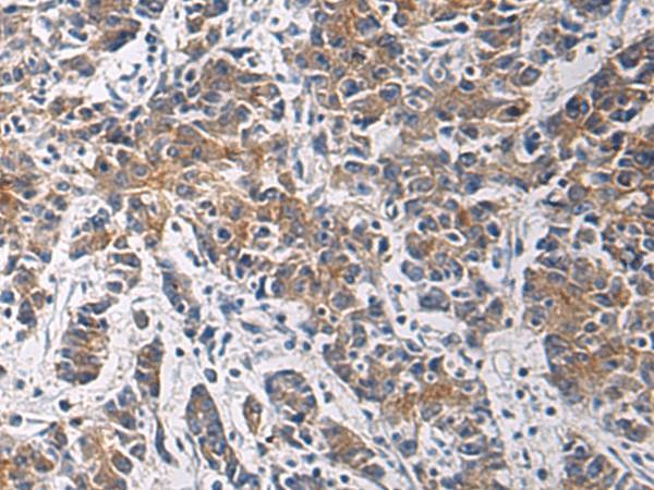 TMOD3 Polyclonal Antibody (E-AB-53165)