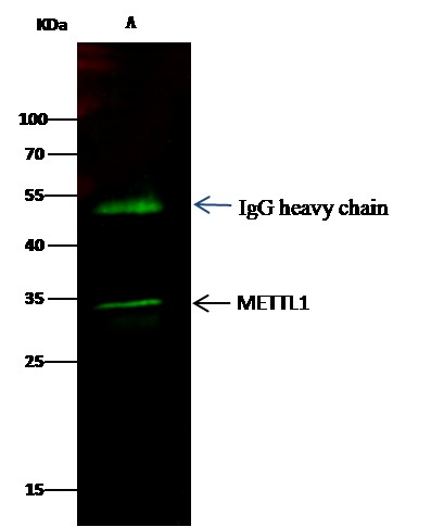 METTL1 Monoclonal Antibody (AN200120P)