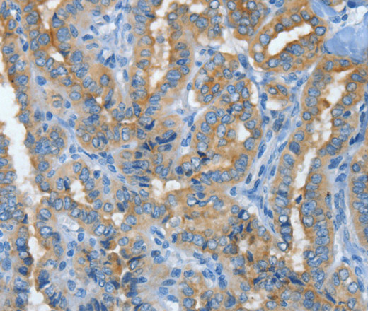 MUC15 Polyclonal Antibody (E-AB-13920)