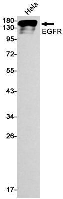 Recombinant EGFR Monoclonal Antibody (E-AB-81439)