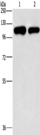 PIP5K1C Polyclonal Antibody (E-AB-16202)