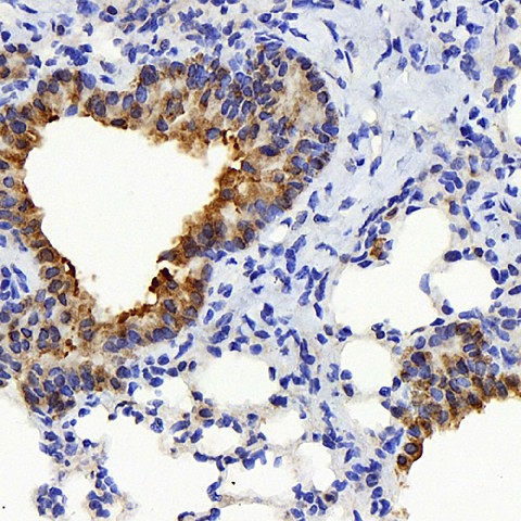TSC22D3 Polyclonal Antibody (E-AB-70164)