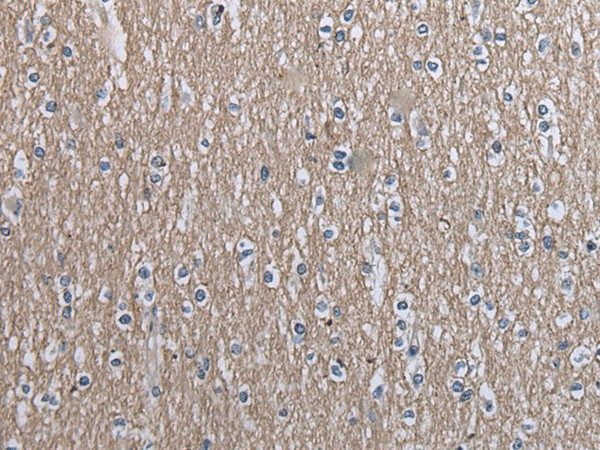 SLC39A14 Polyclonal Antibody (E-AB-52216)