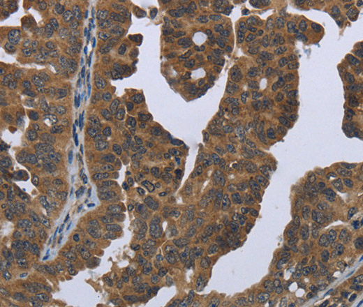 GYS2 Polyclonal Antibody (E-AB-11276)