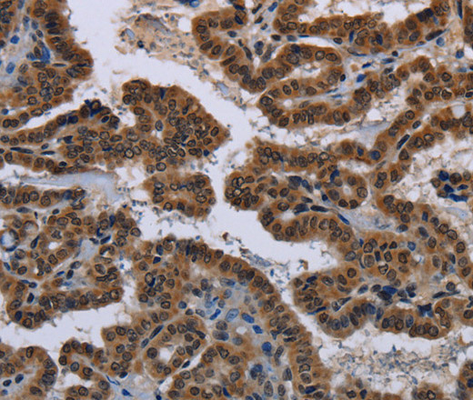MYCN Polyclonal Antibody (E-AB-13462)