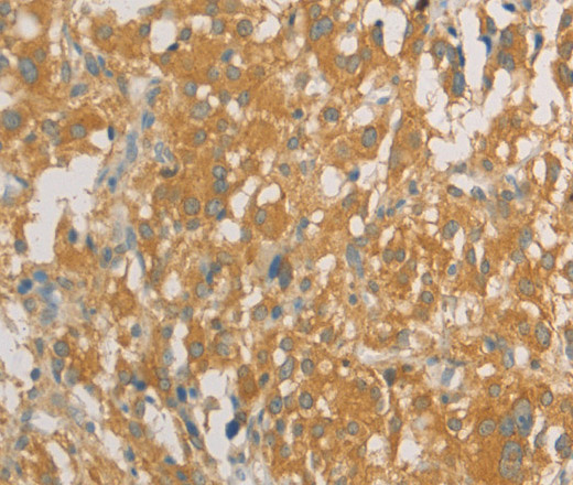 PRPSAP1 Polyclonal Antibody (E-AB-10896)