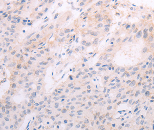 TSHR Polyclonal Antibody (E-AB-14429)