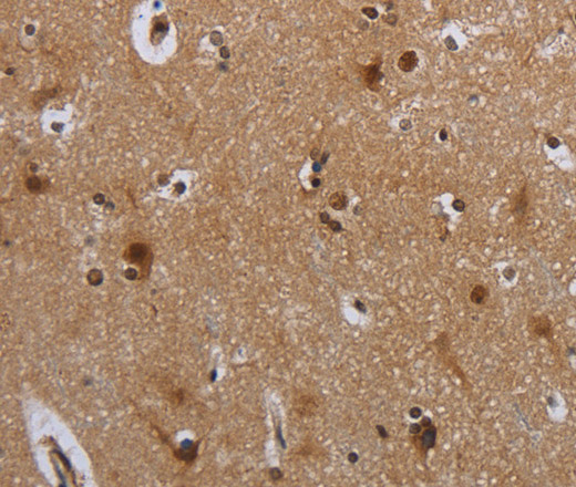 MTBP Polyclonal Antibody (E-AB-13426)