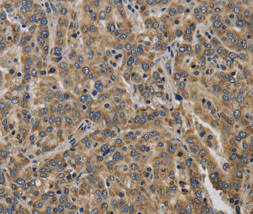 KCNMB2 Polyclonal Antibody (E-AB-16540)