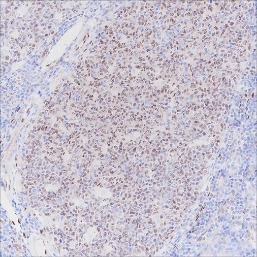 Recombinant LMO2 Monoclonal Antibody (AN301587L)