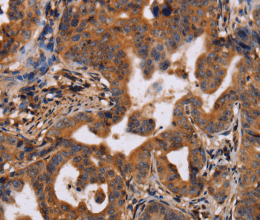 IL12RB2 Polyclonal Antibody (E-AB-16508)
