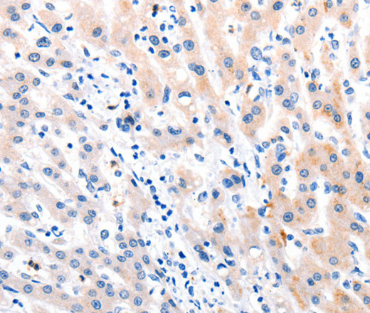 MTOR Polyclonal Antibody (E-AB-12581)