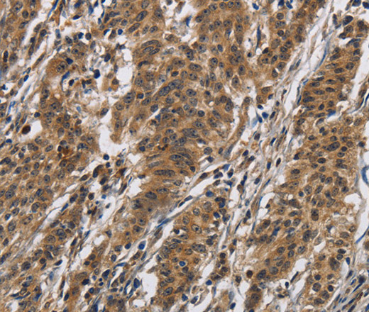 IL12RB2 Polyclonal Antibody (E-AB-13323)