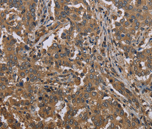 MCC Polyclonal Antibody (E-AB-16596)