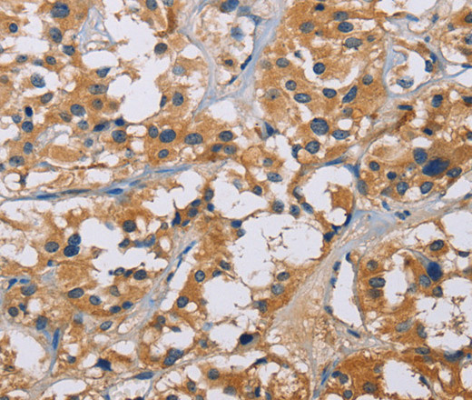 NME5 Polyclonal Antibody (E-AB-10494)