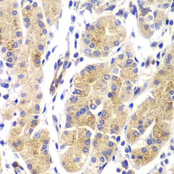 HRas Polyclonal Antibody (E-AB-62098)