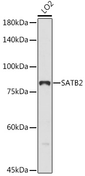 SATB2 Polyclonal Antibody (E-AB-91620)