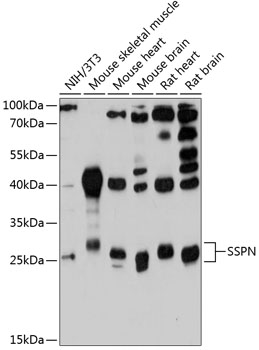 SSPN Polyclonal Antibody (E-AB-90368)
