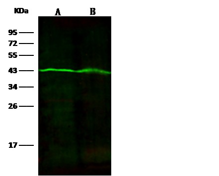 Fumarate Hydratase/FH Monoclonal Antibody (AN200077P)