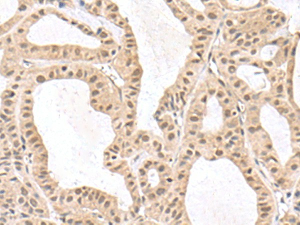 RPS6KA5 Polyclonal Antibody (E-AB-19071)