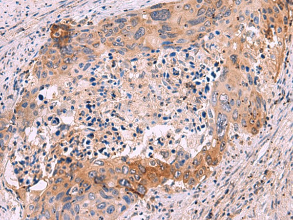 GRIK4 Polyclonal Antibody (E-AB-52061)