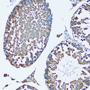 FDFT1 Polyclonal Antibody (E-AB-61840)