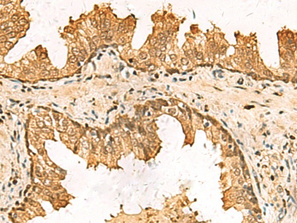 PDXK Polyclonal Antibody (E-AB-53140)