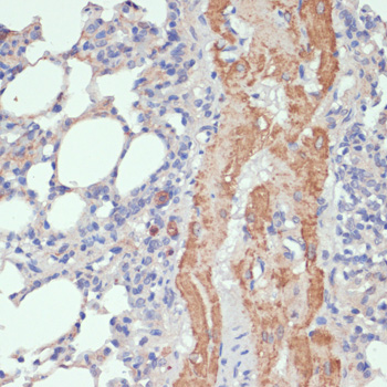 WNT5B Polyclonal Antibody (E-AB-62539)