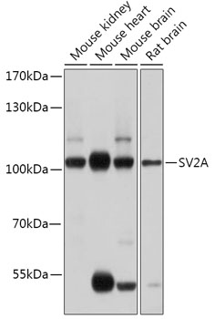 SV2A Polyclonal Antibody (E-AB-91944)