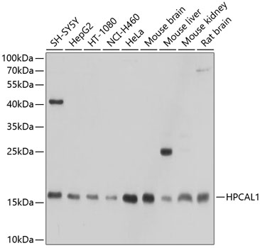 HPCAL1 Polyclonal Antibody (E-AB-92369)