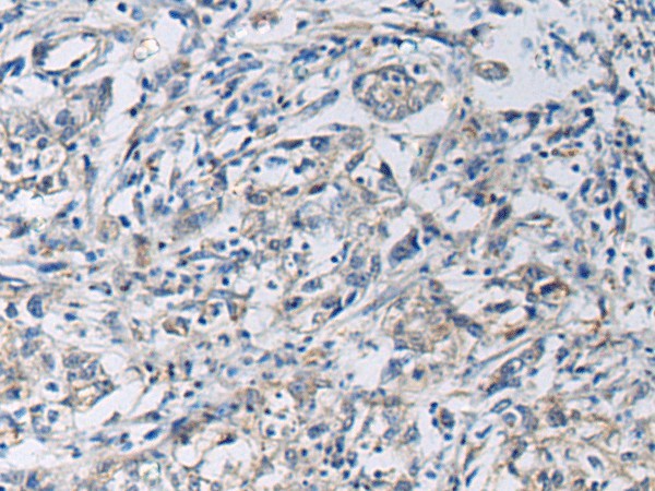 KCNJ10 Polyclonal Antibody (E-AB-53181)