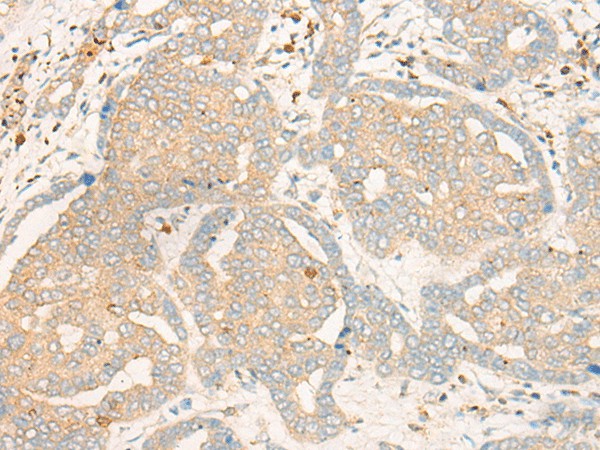 FBXO32 Polyclonal Antibody (E-AB-19785)