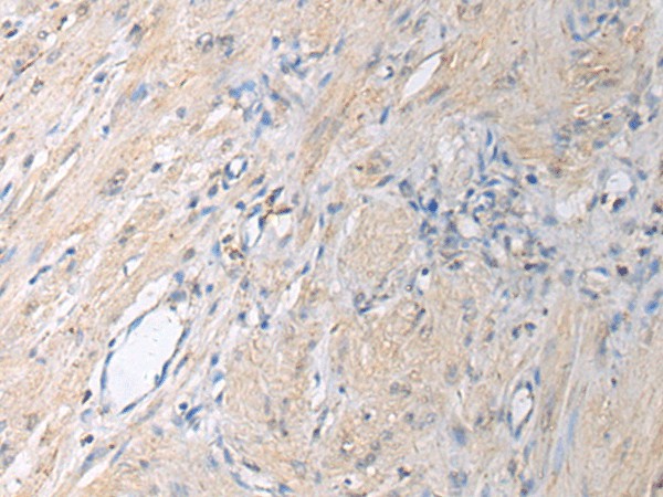 GNAI1 Polyclonal Antibody (E-AB-19249)