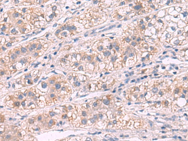 G6PC Polyclonal Antibody (E-AB-18169)