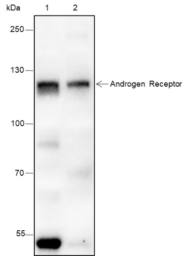 Recombinant Androgen Receptor (CT) Monoclonal Antibody (AN301437L)