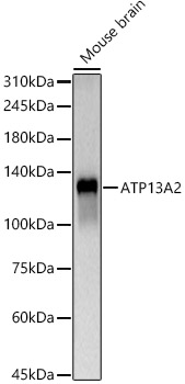 ATP13A2 Polyclonal Antibody (E-AB-90571)