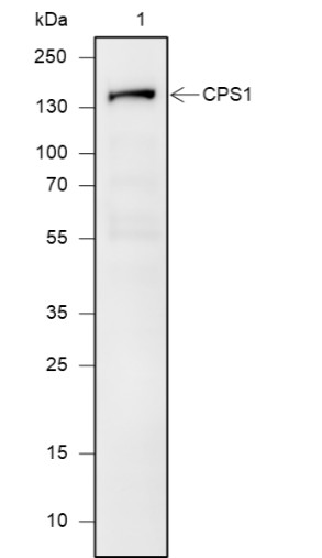 Recombinant CPS1 Monoclonal Antibody (AN301906L)