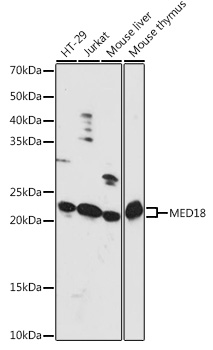 MED18 Polyclonal Antibody (E-AB-90895)