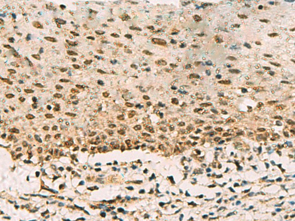PHF5A Polyclonal Antibody (E-AB-19101)
