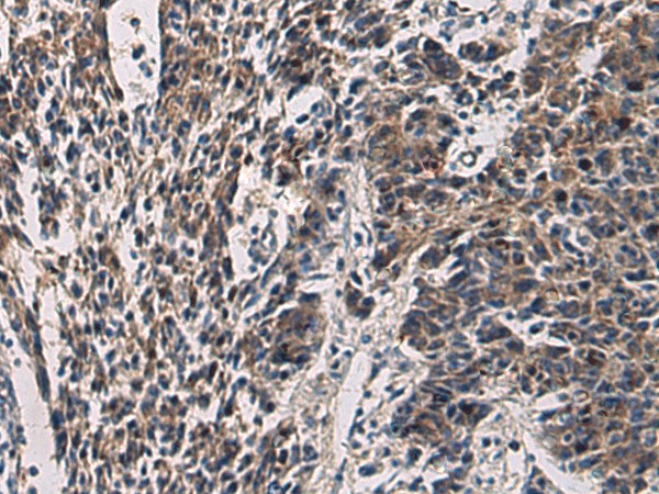 CCNI Polyclonal Antibody (E-AB-53179)