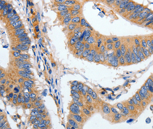 HSPA1A Polyclonal Antibody (E-AB-14137)