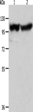 ACTN3 Polyclonal Antibody (E-AB-10723)