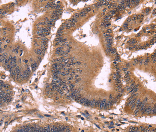 CCDC106 Polyclonal Antibody (E-AB-14831)