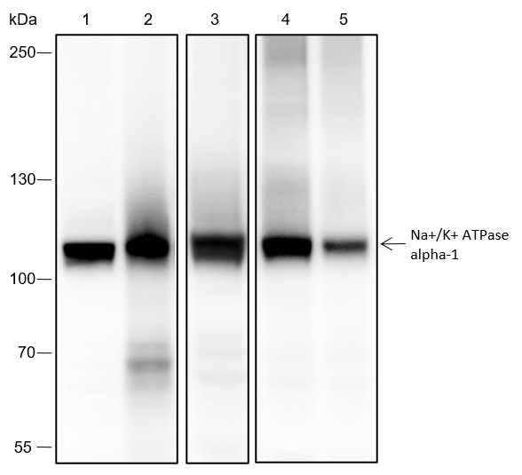 Recombinant Na+/K+ ATPase alpha-1 Monoclonal Antibody (AN301712L)
