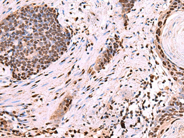 NASP Polyclonal Antibody (E-AB-52960)