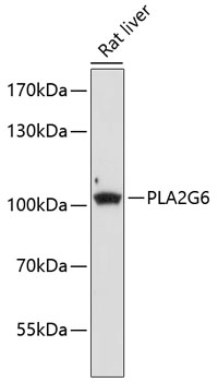 PLA2G6 Polyclonal Antibody (E-AB-68019)