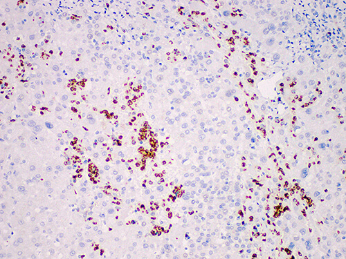 MPO Monoclonal Antibody (ELAB6663-M)