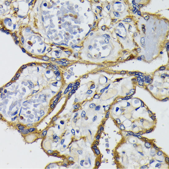 IQGAP1 Polyclonal Antibody (E-AB-65520)