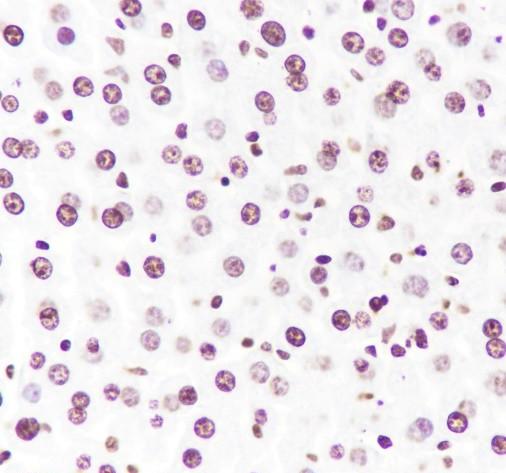 Recombinant Histone H3 (CT) Monoclonal Antibody (AN301708L)