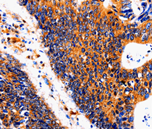 IL18BP Polyclonal Antibody (E-AB-13876)